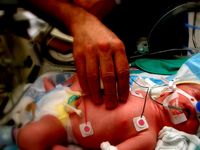 Neonate